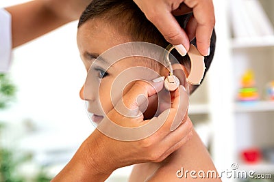 Placement of the hearing aid medical device Stock Photo